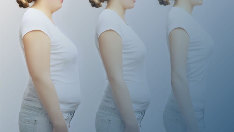 Imagem ilustrando a evolução da perda de peso, com três estágios de emagrecimento de uma mulher vista de perfil.